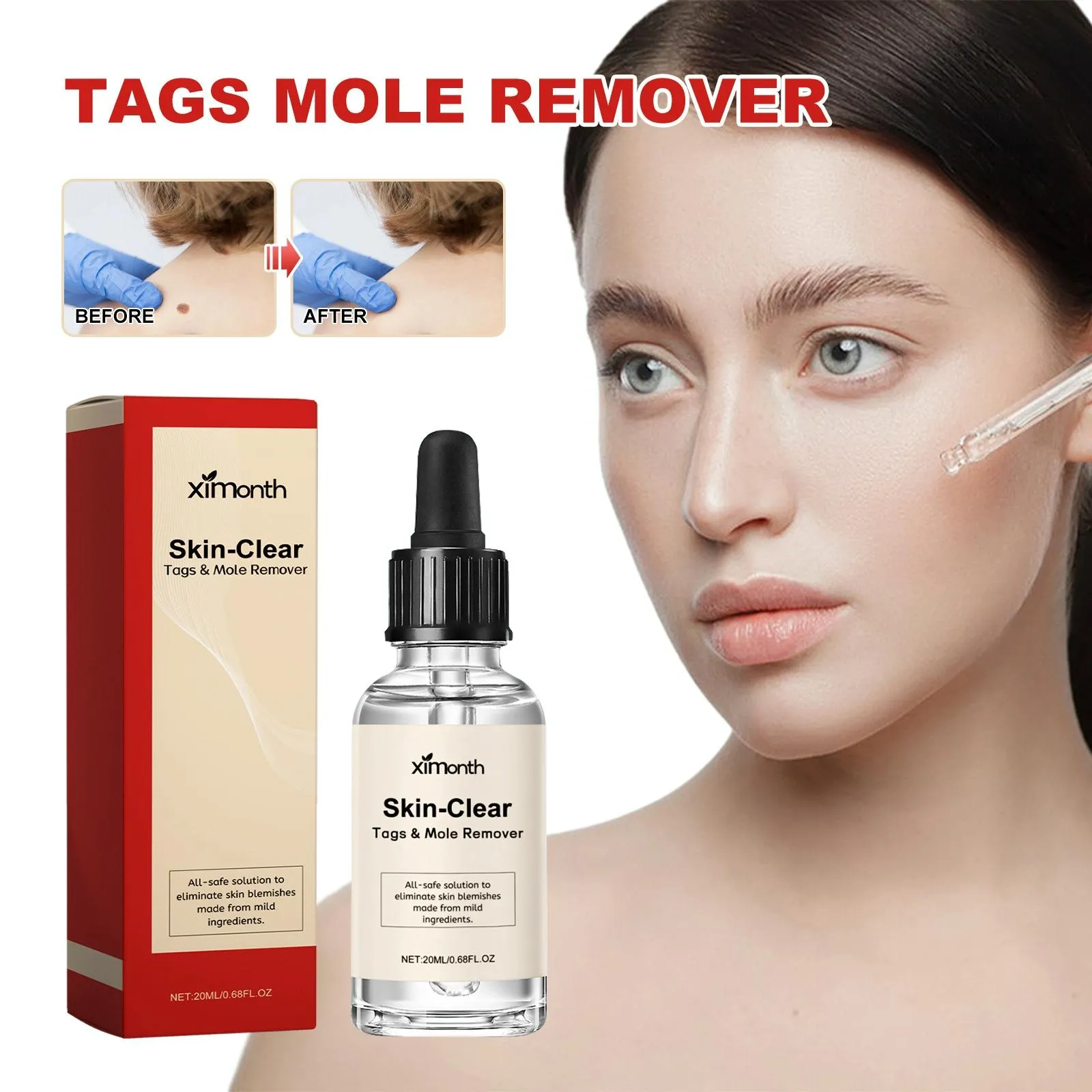 30Ml Anti Mole & Wart Liquid Dark Spot Tag Remover Essence