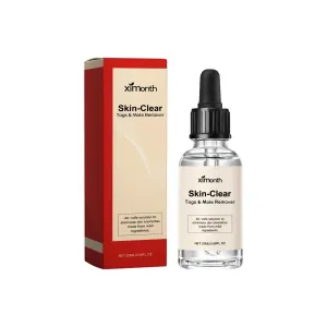 30Ml Anti Mole & Wart Liquid Dark Spot Tag Remover Essence