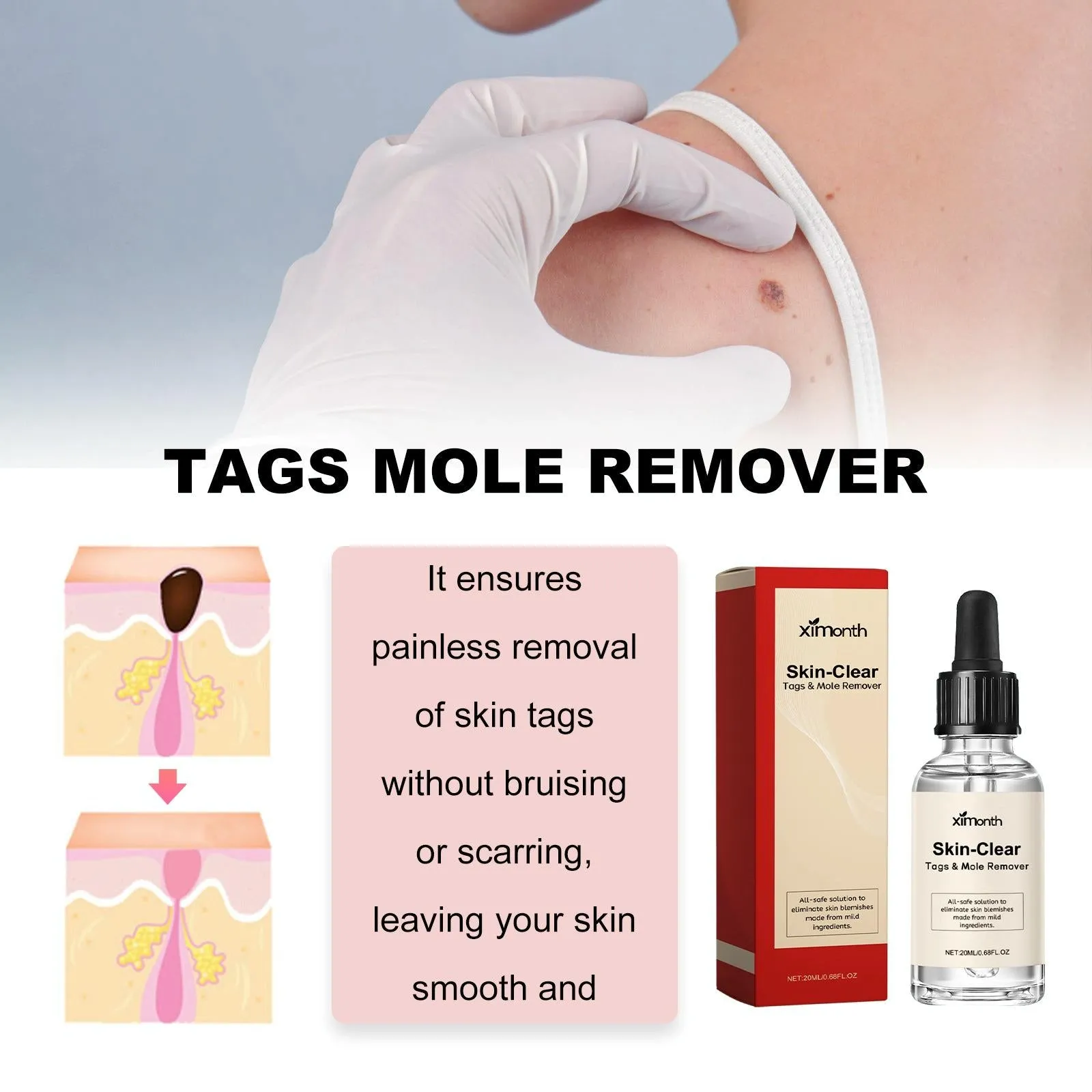 30Ml Anti Mole & Wart Liquid Dark Spot Tag Remover Essence