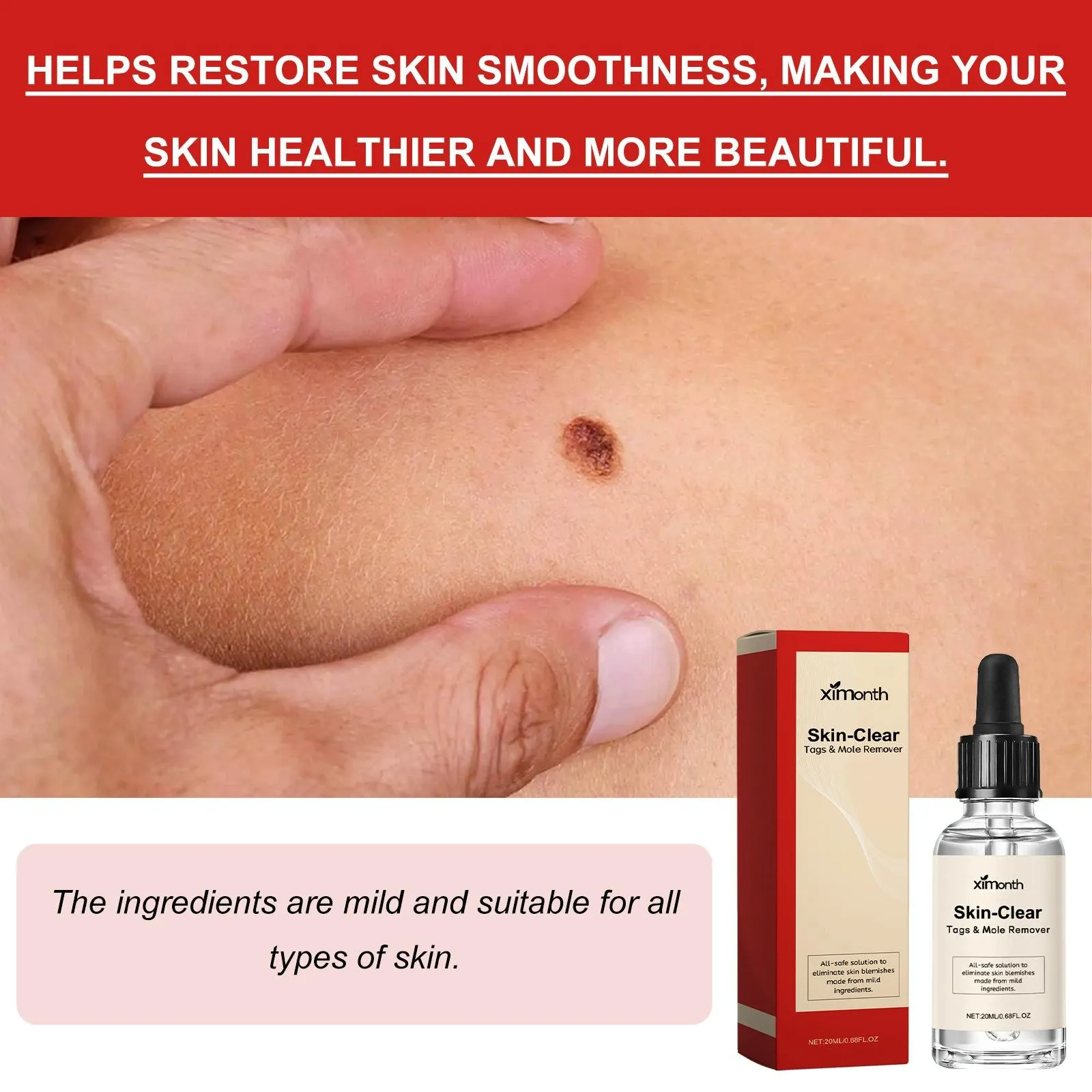 30Ml Anti Mole & Wart Liquid Dark Spot Tag Remover Essence